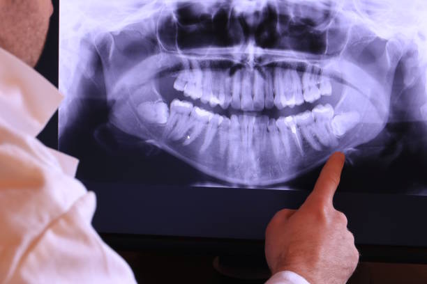 Best Weekend Emergency Dentist in Lexington, NE